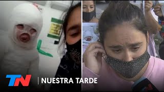 Una empleada de un restaurante le volcó aceite hirviendo a una nena de 3 años en Florencio Varela