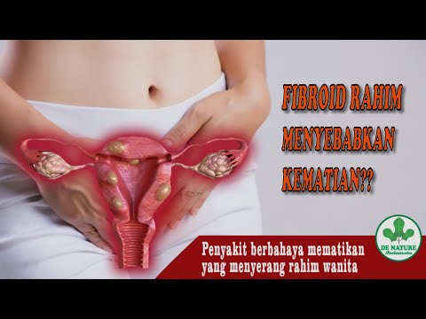 WASPADA!! GEJALA UTAMA PENYAKIT FIBROID RAHIM YANG BERBAHAYA!!!