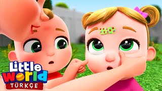 Bacağım Uf Oldu, Pansuman Şarkısı Eğlenceli Ve Öğretici Çocuk Şarkıları Little World Türkçe