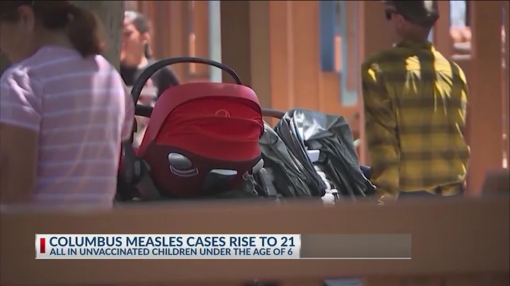 Columbus measles cases rise to 21