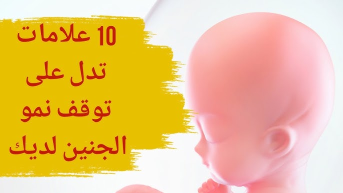 بعد كم يوم من توقف نبض الجنين ينزل الدم؟