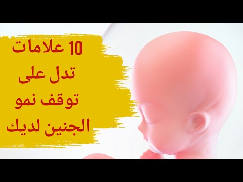 فيديو: كيف تتحقق مما إذا كان الحمل يتطور