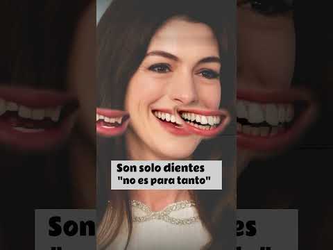 Antes y después, Los dientes son tu carta de presentación. #dentista #estéticadental