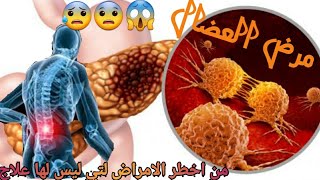 مرض العضال | تعرفوا عليه