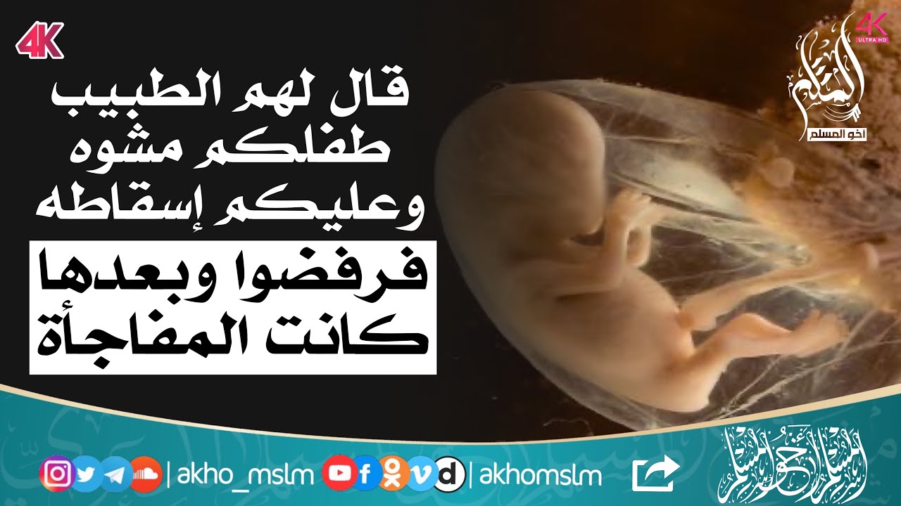 قيل لهم طفلكم مشوه وعليكم إسقاطه فرفضوا وبعدها كانت المفاجأة - الشيخ محمد بن صالح العثيمين رحمه الله
