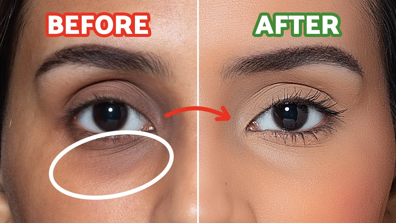 How To Make Dark Circles Disappear