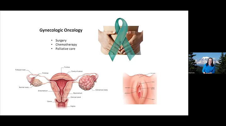 Understanding ovarian cancer: a journey to persona...