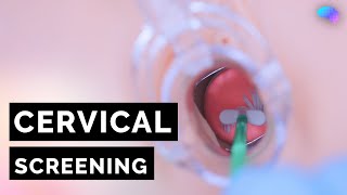 Cervical Screening (Smear) | HPV | OSCE Guide | UKMLA | CPSA screenshot 3