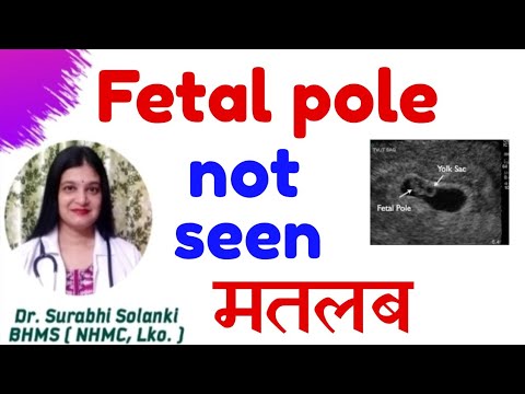 Yolk sac and fetal pole not seen meaning in hindi | Empty gestational