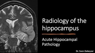 Radiology of the hippocampus - Acute hippocampal disease