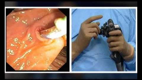 Dr Nageshwar Reddy/Case1