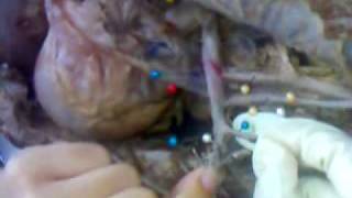 Arteria Toracica Dir.3Gp