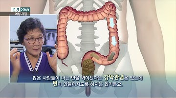 knn건강365 강경숙원장 여성치질 180801