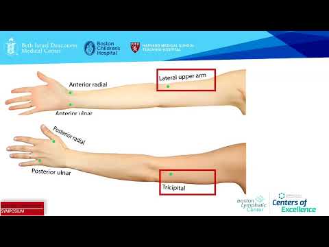 Lymphatic Research Presented by the BIDMC Research Team – BIDMC Research Team | BLS 2023
