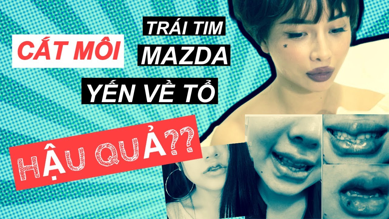 CẮT MÔI TRÁI TIM - MÔI MAZDA - TRÀO LƯU TAI HẠI | RIN NGUYEN LÀM ĐẸP ...