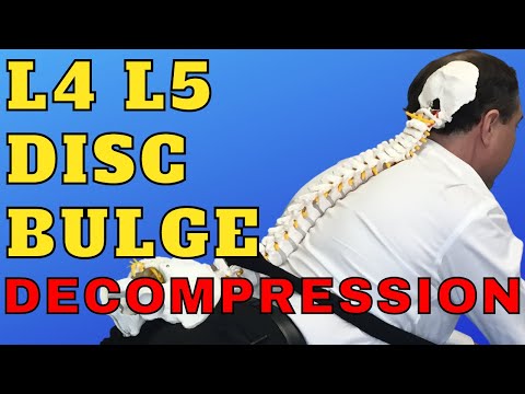 L4 L5 ڈسک بلج Decompression مشقیں | L4 L5 ڈسک بلج کے ل Best بہترین ورز...