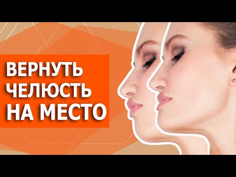 Как ИСПРАВИТЬ мезиальный прикус БЕЗ ОПЕРАЦИИ. Миогимнастика в домашних условиях