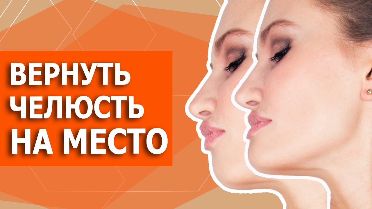 Как ИСПРАВИТЬ мезиальный прикус БЕЗ ОПЕРАЦИИ. Миогимнастика в домашних условиях