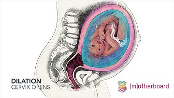 Effacement and Dilation