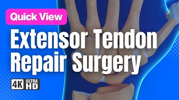 Extensor Tendon Injury Surgical Repair // See How It Works // 3D Animation