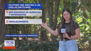 Las Huellas Dactilares Se Borran? Tcs Ahora El Salvador