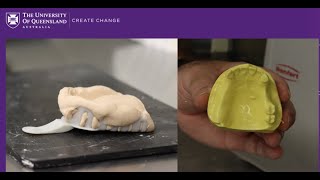 Pouring up alginate impressions with type III Dental Stone