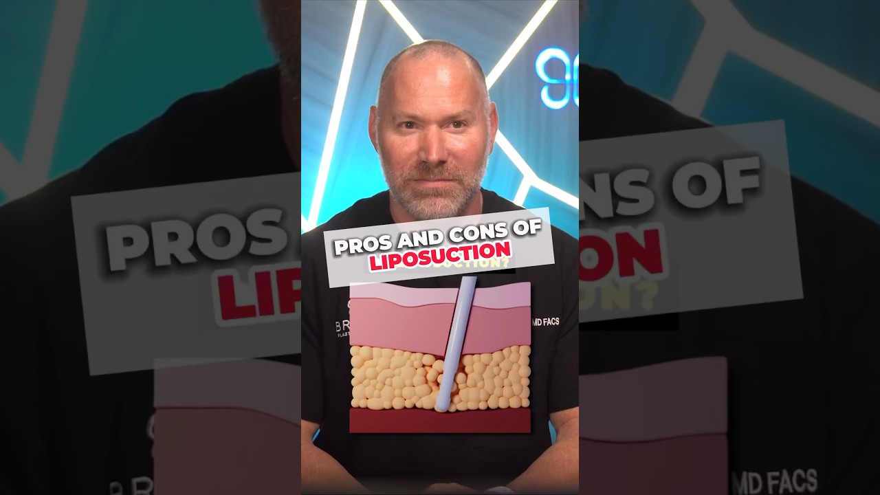 Watch This Before You Get Lipo ✅