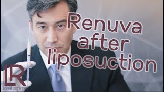 Renuva is used to correct liposuction irregularities