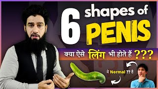 6 Shapes Of P*nis | टेढ़ा, पतला, छोटा - क्या ये Normal है 