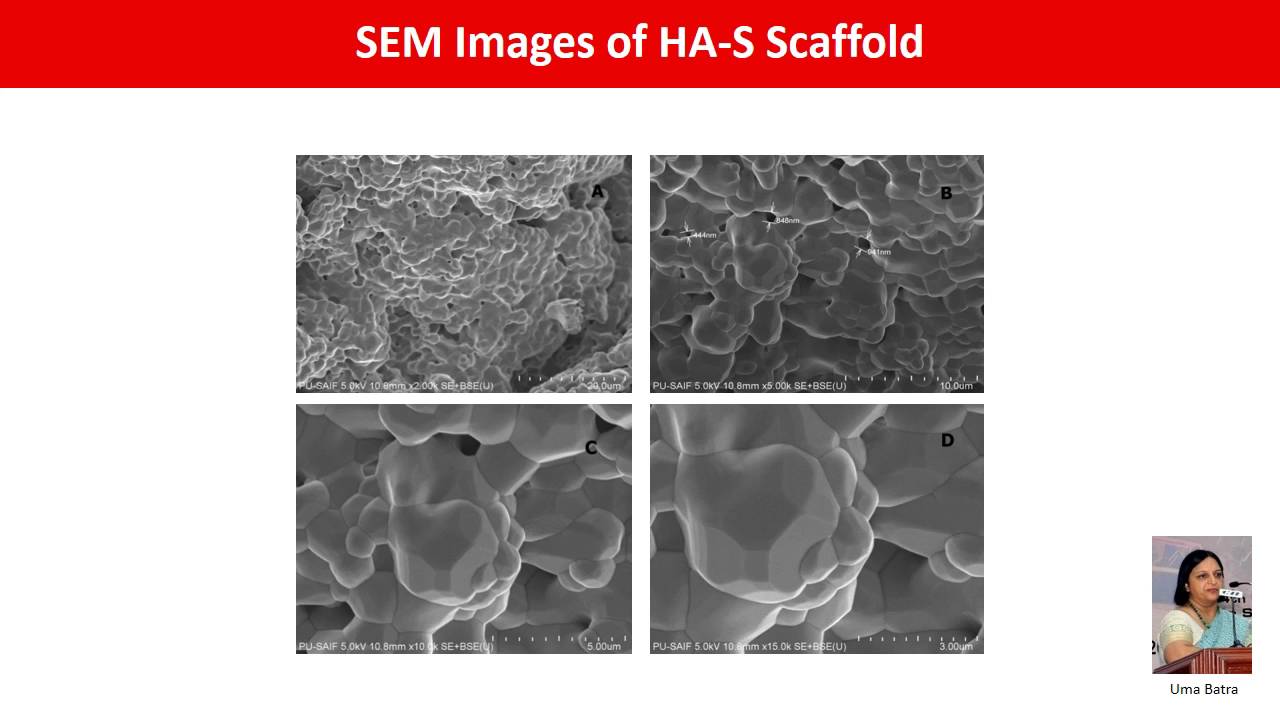 Ionic Substituted Hydroxyapatite Scaffolds Prepared by Sponge Replication Technique for Bone Regeneration