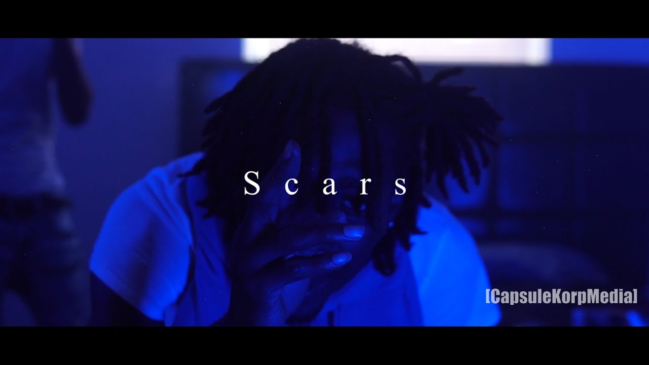 Watch Soso - Scars ( Official Video ) on YouTube Watch Soso - Scars ( Official Video ) on YouTube