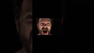 Ubruxum - Intestinal Rupture