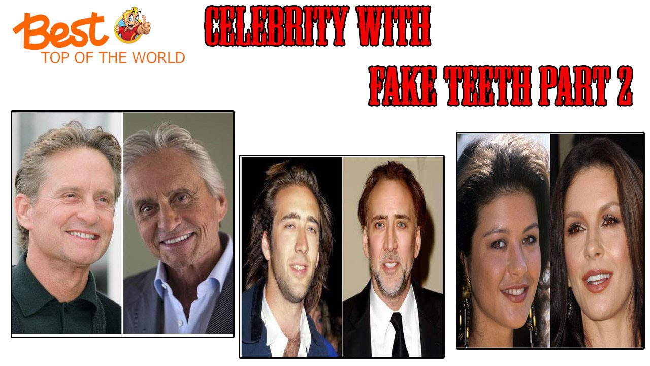 Best Top 10 Celebrities with Fake Teeth part 2 - YouTube