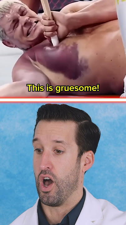 ER Doctor REACTS to WWE Injuries #2