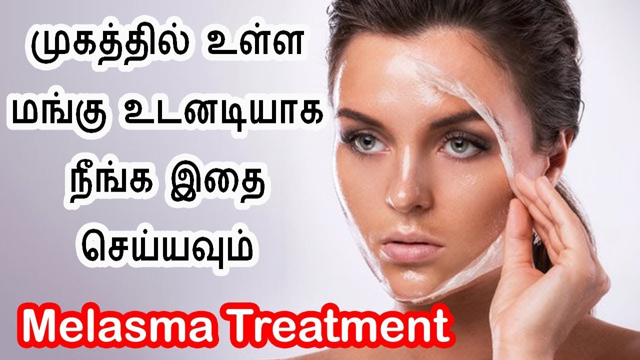 How to Cure Mangu beauty tips for face melasma marks removal