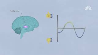 How Your Brain Works When Youre Depressed  Better  NBC News