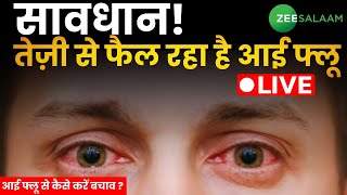 Eye Flu Treatment | सावधान तेज़ी से फैल रहा है आई फ्लू | Conjunctivitis scare | Zee Salaam LIVE