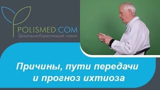 Заболевание ихтиоз: причины, пути передачи, прогноз. Врожденный и приобретенный ихтиоз