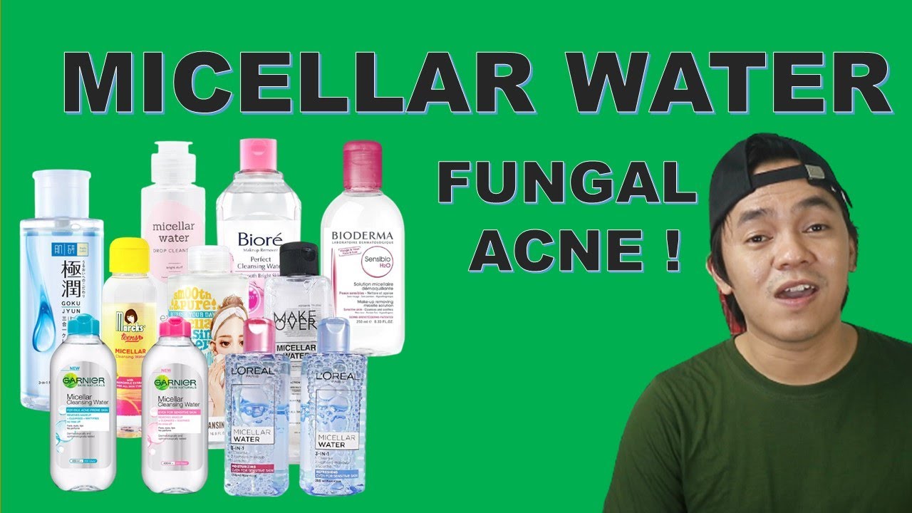 micellar water fungal acne safe
