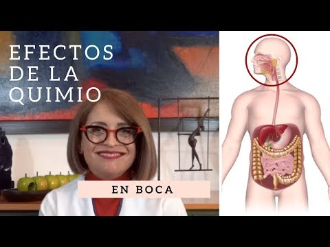 Efectos de la quimioterapia: EN BOCA [Hemato-oncología]