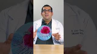 What is a biopsy? What is a biopsy?