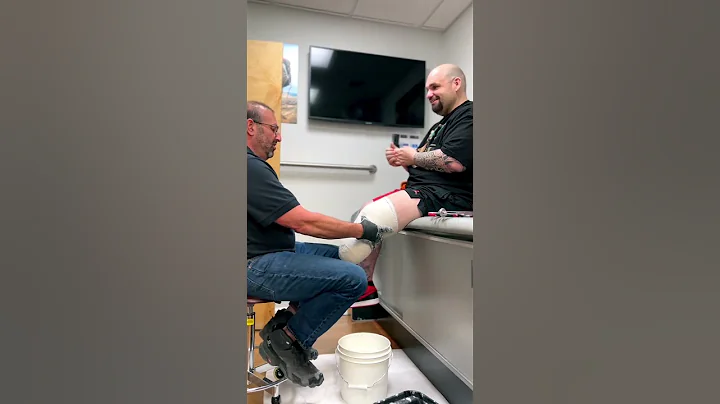 Prosthetic Casting For Below Knee Amputee| BTS