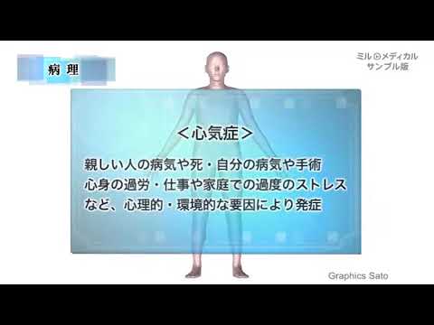 心気症／ミルメディカル 家庭の医学 動画版