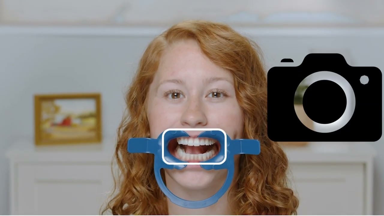 口腔内写真の撮影手順@今井矯正歯科 木更津市