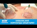 NewTV// ХИЖАМА КӨП ООРУЛАРДЫ АЙЫКТЫРАТ // ДАБАГЕР