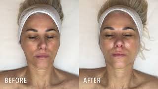 The Collagen Renew Facial