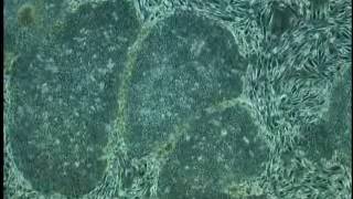 Self renewing of Human iPS cells after passaging