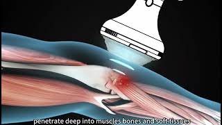 Ultra Focusing Shock Wave Horse Pain Machine | High-Intensity Focused Shockwave Therapy
