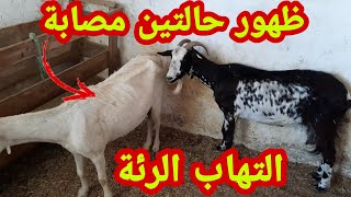 كيفية التعرف على مرض التهاب الرئة والدواء المستعمل للعلاج