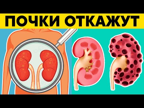 15 явных признаков того, что Ваши ПОЧКИ скоро ОТКАЖУТ